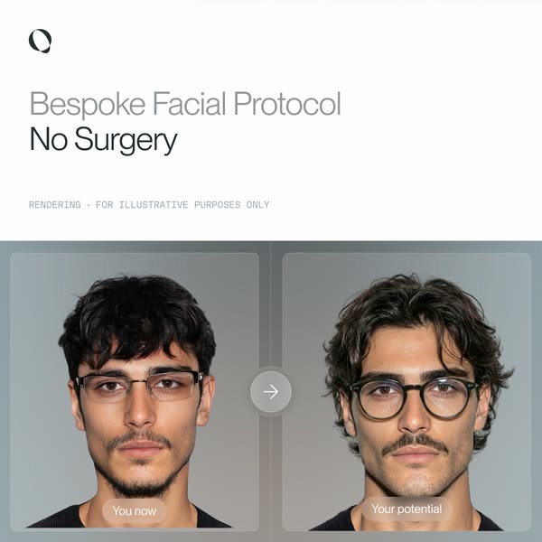 QOVES